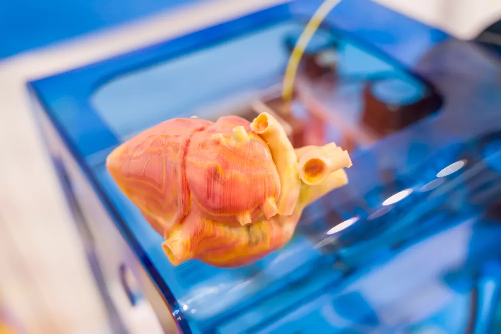 Impression 3d Medicale1