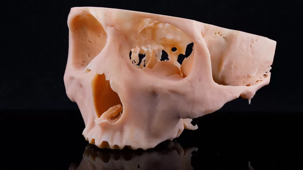 Impression 3d Secteur Sante