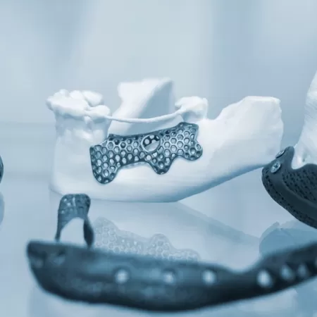 Imprimante 3d Sante1