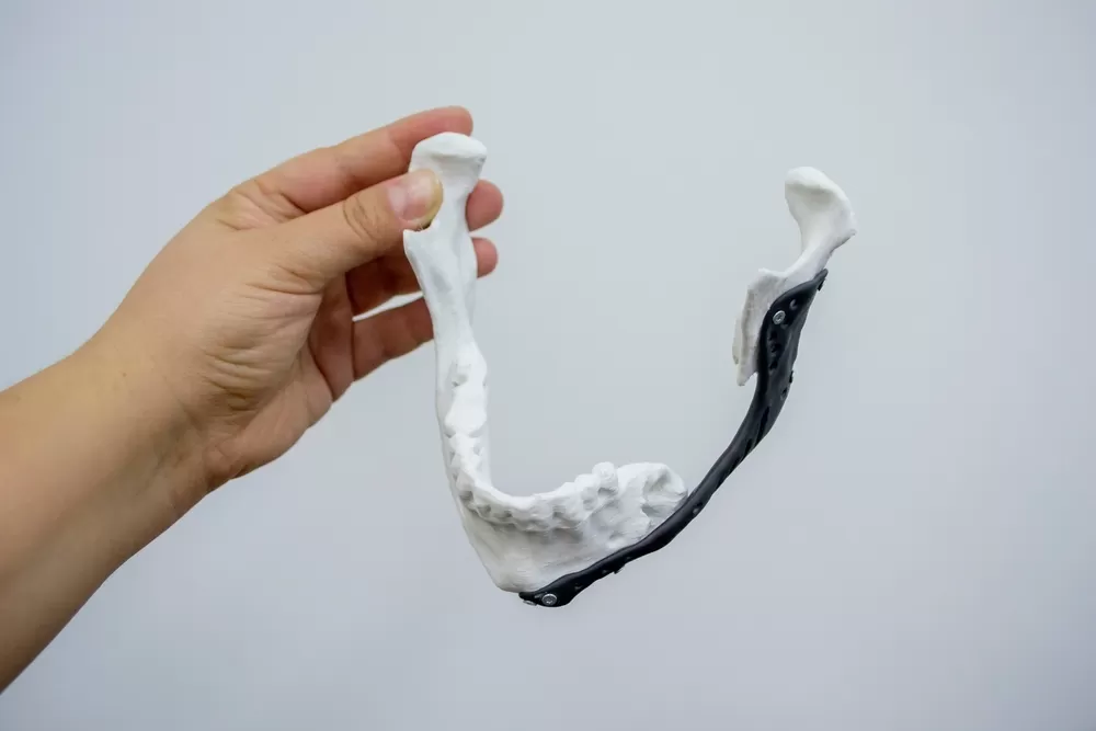 Modeles Medicaux 3d 1