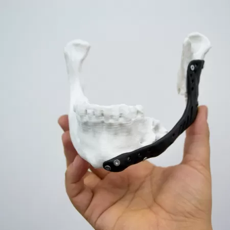 Production 3d Dans Le Secteur De La Sante