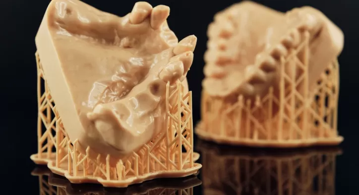 Impression 3D Dentaire